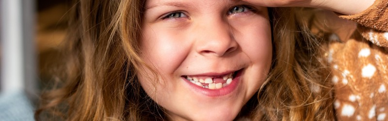 Smilende pige som mangler et par mælketænder